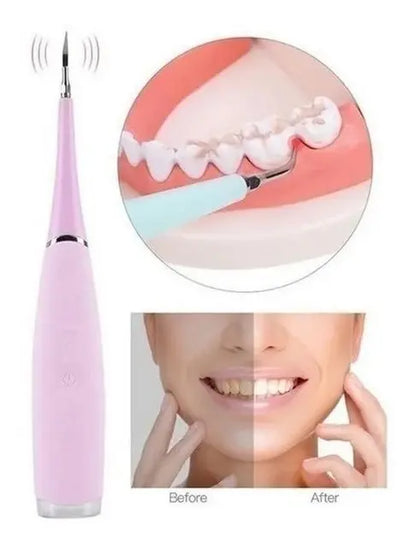 Removedor de sarro Dental Recargable