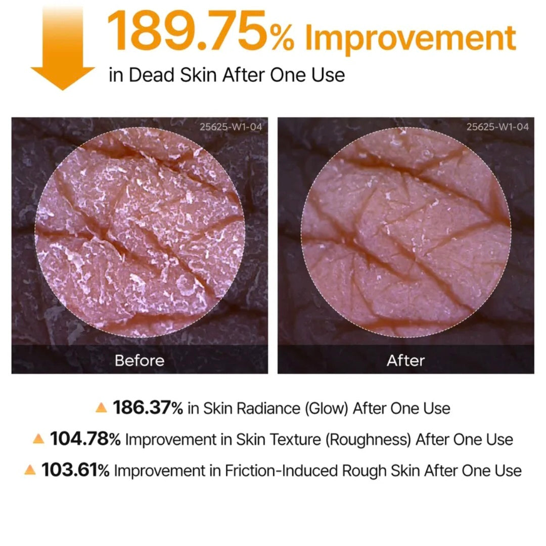 Dr.Melaxin - Spray corporal exfoliante Peel Shot con ácido kójico y cúrcuma
