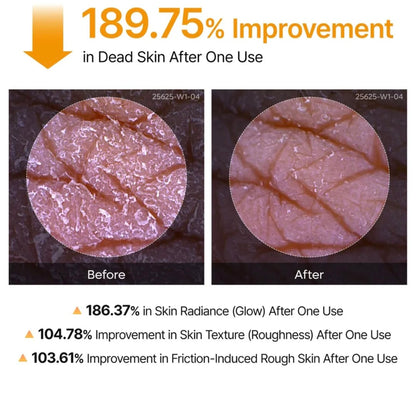 Dr.Melaxin - Spray corporal exfoliante Peel Shot con ácido kójico y cúrcuma