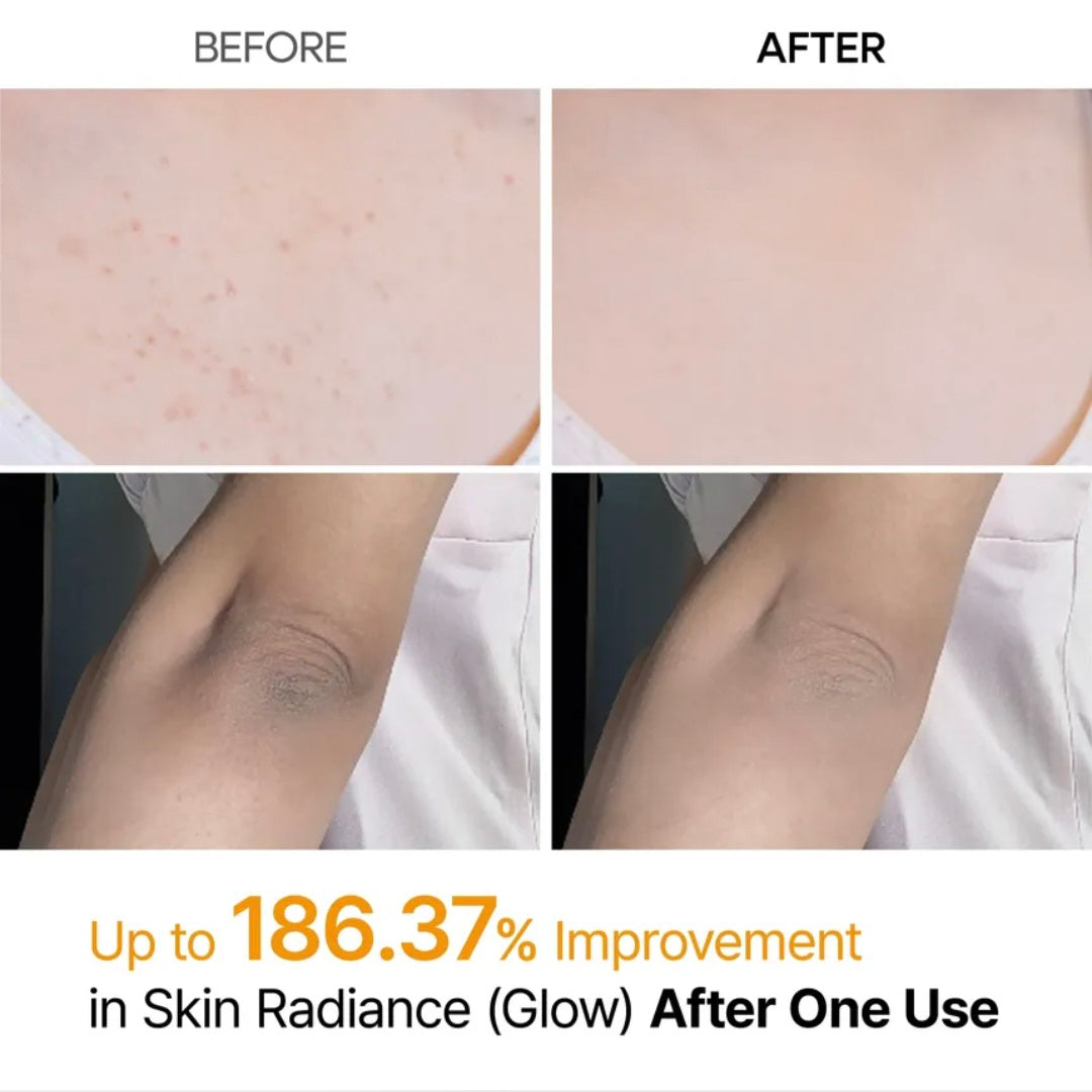 Dr.Melaxin - Spray corporal exfoliante Peel Shot con ácido kójico y cúrcuma